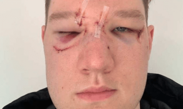 NSW juvenile justice officers walk off job after string of violent attacks by offenders – ABC News 09/06/2019